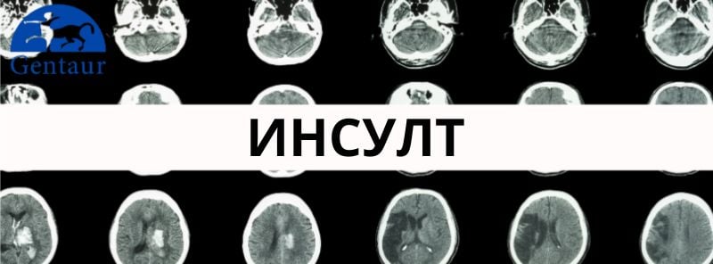 Инсулт