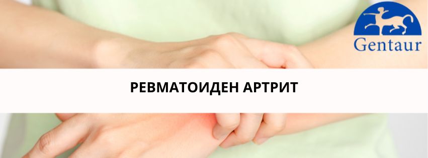 Revmatoiden artrit izobrazhenie na statiiata