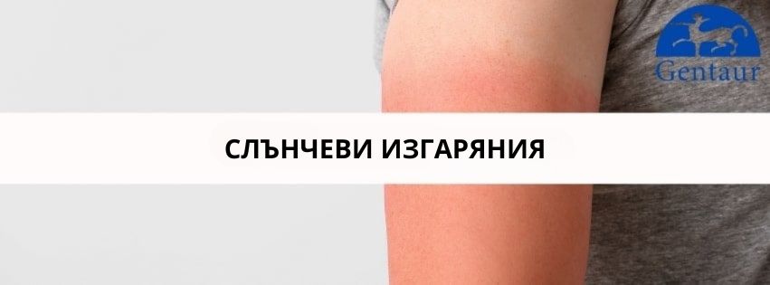 Slienchevo izgariane kak da igraem bezopasno na slientse glavna snimka